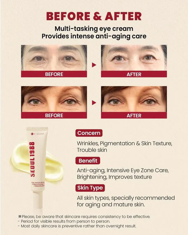 KSECRET | SEOUL 1988 Eye Cream : Retinal Liposome 4% + Fermented Bean 30ml