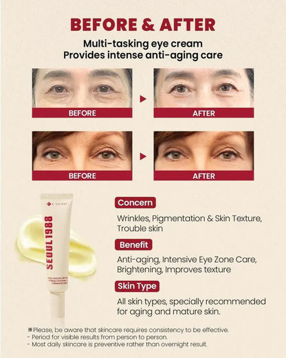 KSECRET | SEOUL 1988 Eye Cream : Retinal Liposome 4% + Fermented Bean 30ml